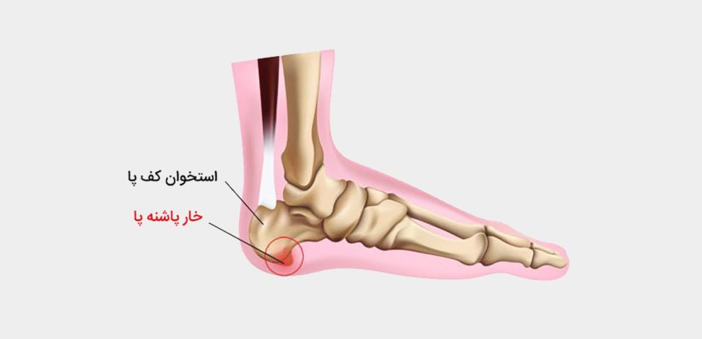 کفی طبی ژله‌ای