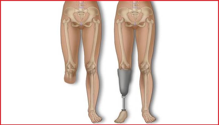 علل مشکلات پوستی در افراد آمپونه