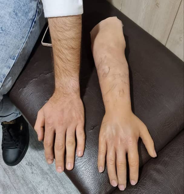 پروتز دست