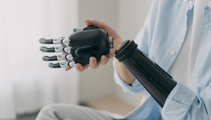 نحوه افزایش عمر پروتز دست