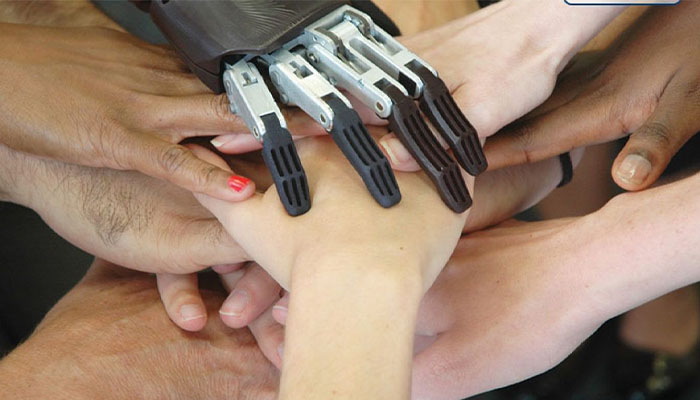 ویژگی های پروتز دست مکانیکی
