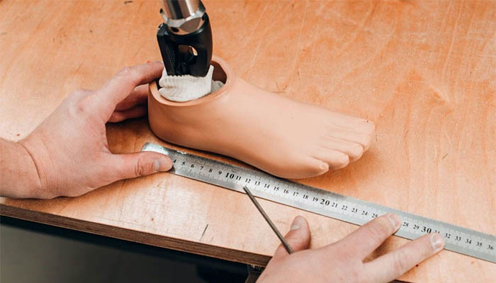 پروتز پای دیابتی