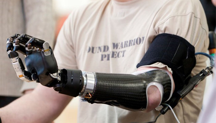 وپژگی های پروتز مایوالکتریک