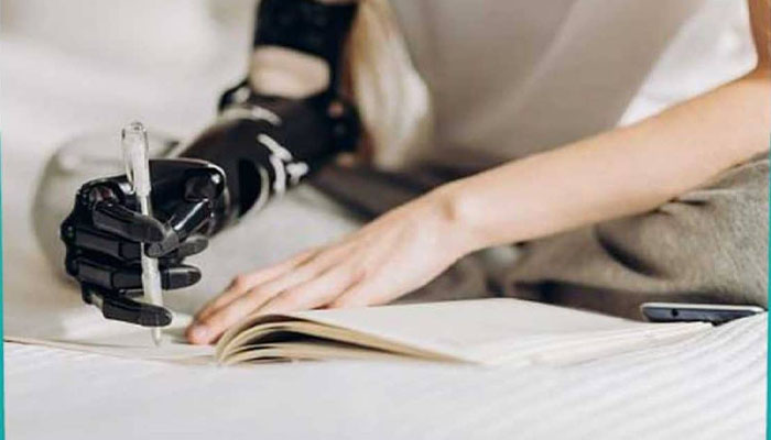 وپژگی های پروتز مایوالکتریک