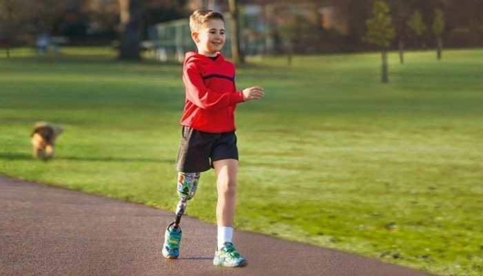 پروتز پا برای کودکان