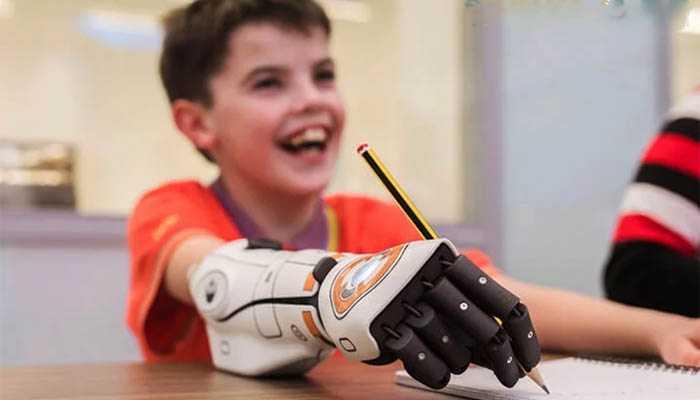 پروتز دست برای کودکان