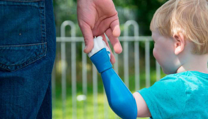 پروتز دست برای کودکان