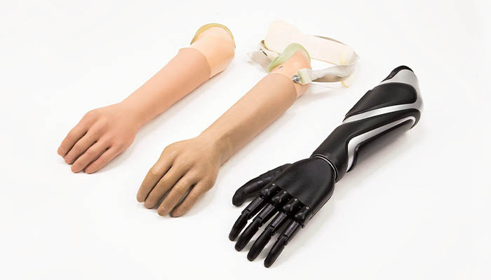 راهنمای کامل انتخاب پروتز دست مصنوعی