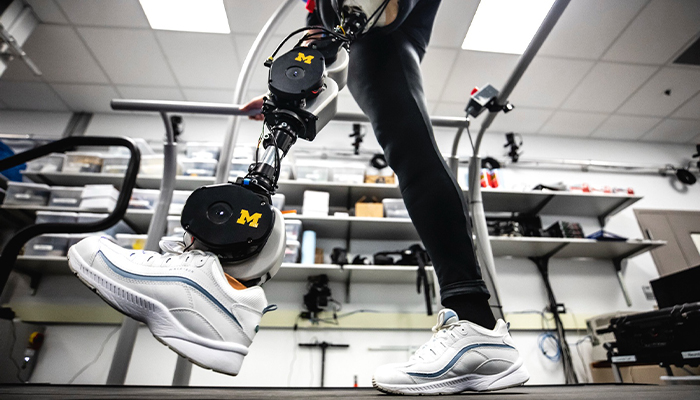 پروتز پای هوشمند