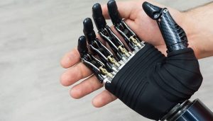 بهترین متریال برای ساخت پروتز دست