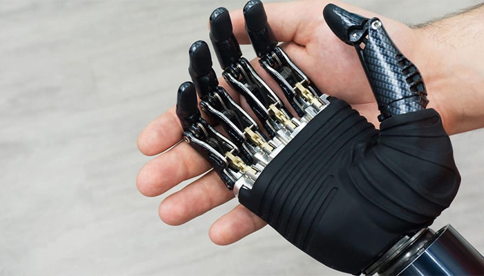 بهترین متریال برای ساخت پروتز دست