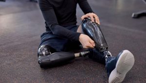 طول عمر پروتز زانو