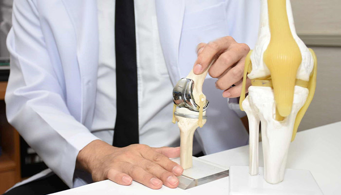 طول عمر پروتز زانو