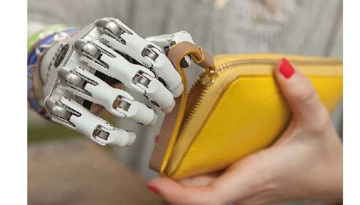 قیمت پروتز دست در سال ۱۴۰۴