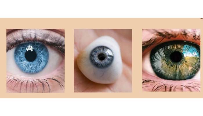 مقایسه انواع پروتز چشم