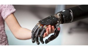 پروتز دست هوشمند
