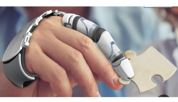 پروتز دست هوشمند