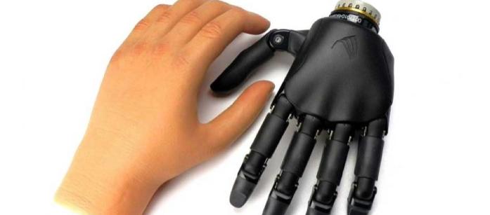 دست مصنوعی الکترونیکی چیست؟