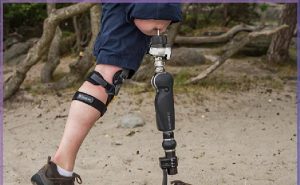 قیمت پروتز پا در سال ۱۴۰۴