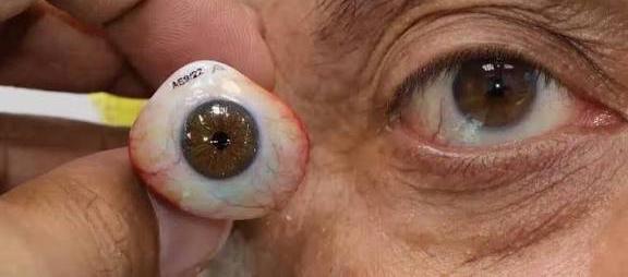 پروتز چشم یا چشم مصنوعی مناسب چه کسانی است؟