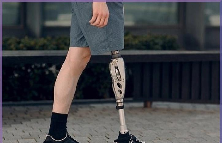 انجام پروتز پا با بهترین قیمت به کجا مراجعه کنیم؟