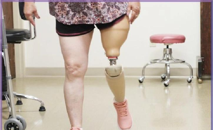 بررسی عوامل موثر بر قیمت پروتز پا در سال ۱۴۰۴