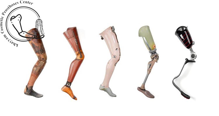 پروتز روی زانو