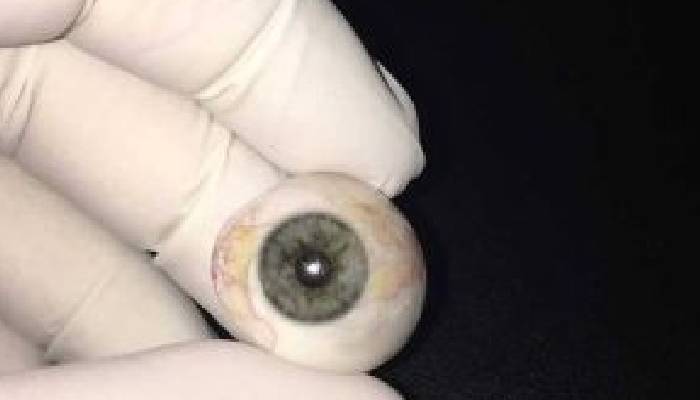 استفاده از پروتز چشم ویژه افراد مسن