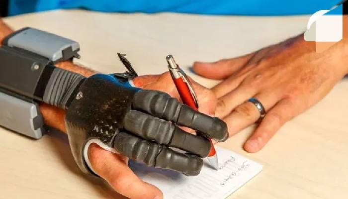 نکات مهم قبل از سفارش پروتز دست