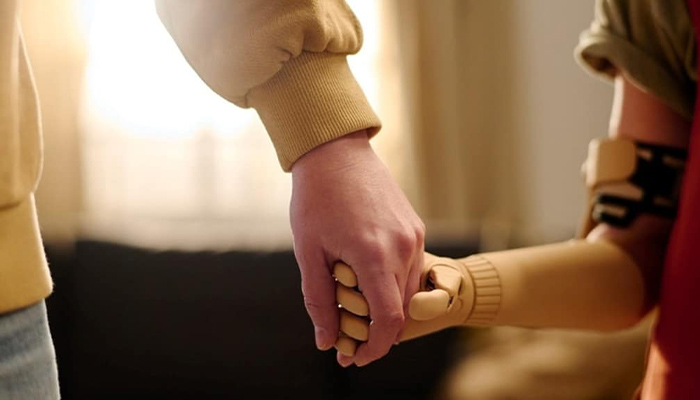 پروتز اندام فوقانی