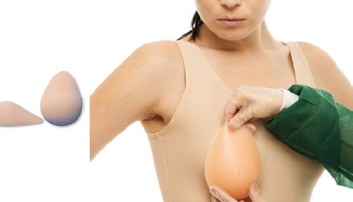 پروتز سینه در موارد برداشت سینه در اثر سرطان