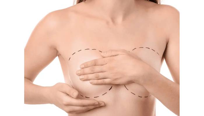 دلیل تعویض پروتز سینه