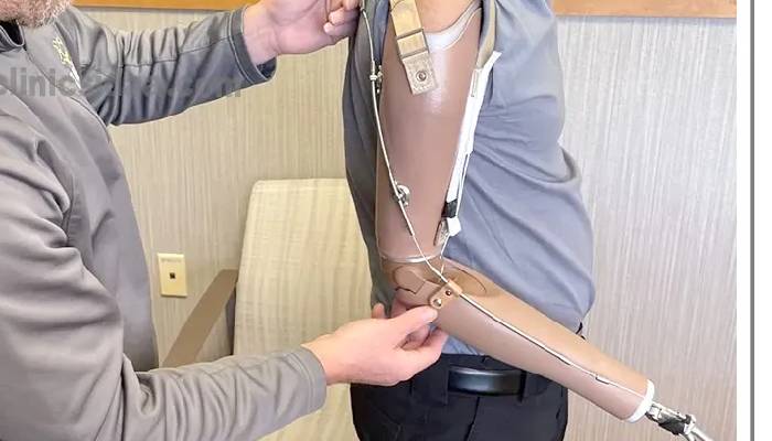 پروتز قطع ارنج