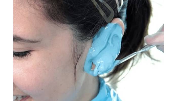 نحوه ساخت پروتز گوش