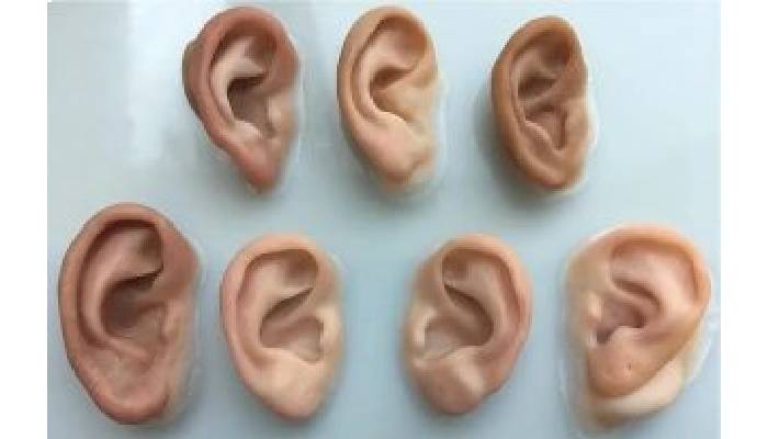 نحوه ساخت پروتز گوش