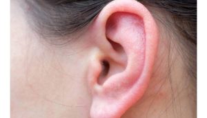 نحوه ساخت پروتز گوش