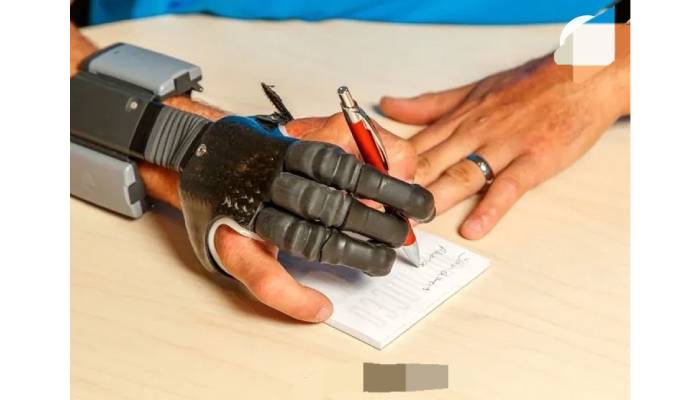 بهترین پروتز دست برای ورزشکاران