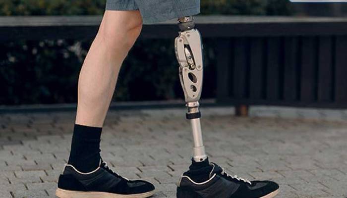 روند بازگشت توان حرکتی پس از قطع عضو