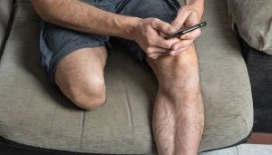 روند بازگشت توان حرکتی پس از قطع عضو