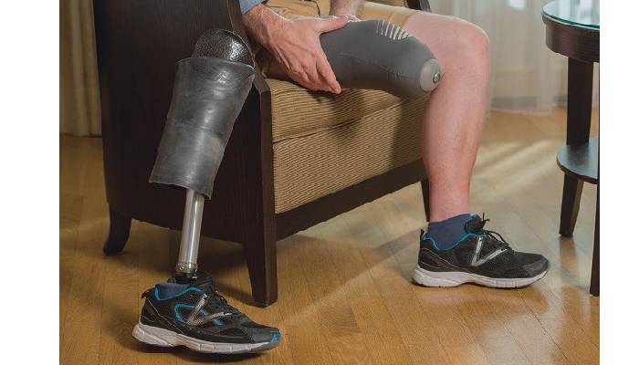 پروتز قطع عضو بالای زانو