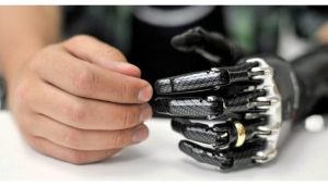 پروتز هوشمند دست