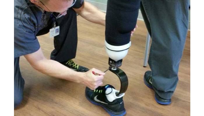 پروتز پا هوشمند