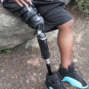 اهمیت بررسی سبک زندگی بیمار در انتخاب نوع پروتز