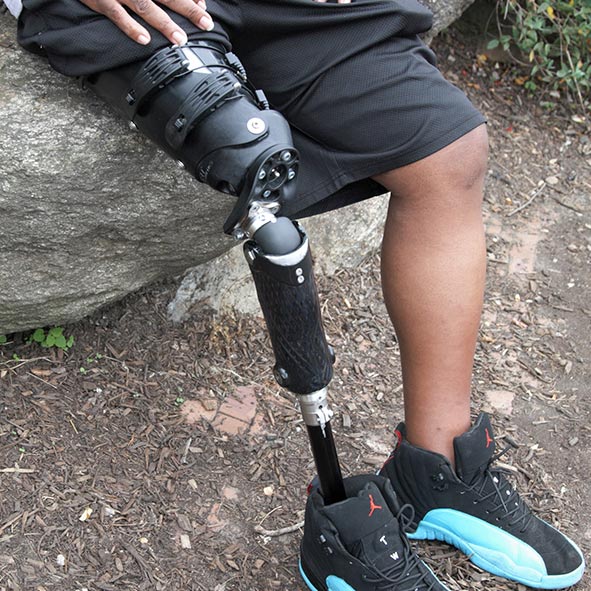 اهمیت بررسی سبک زندگی بیمار در انتخاب نوع پروتز