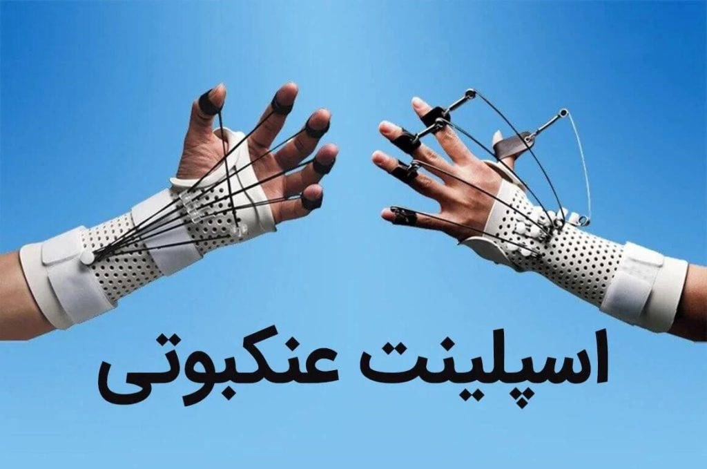 اسپلینت عنکبوتی