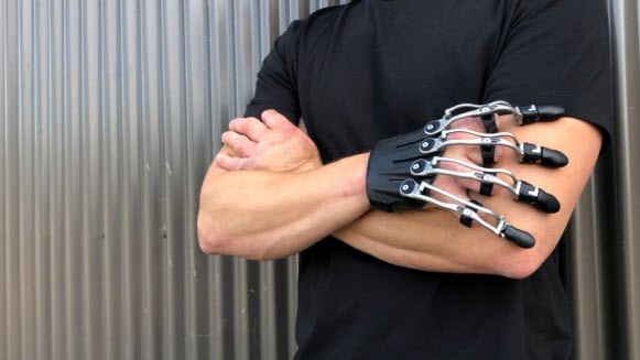 انجام کارهای ظریف با پروتز انگشت دست با کمک پروتزهای فعال انجام کارهای ظریف با پروتز انگشت دست با کمک پروتزهای فعال