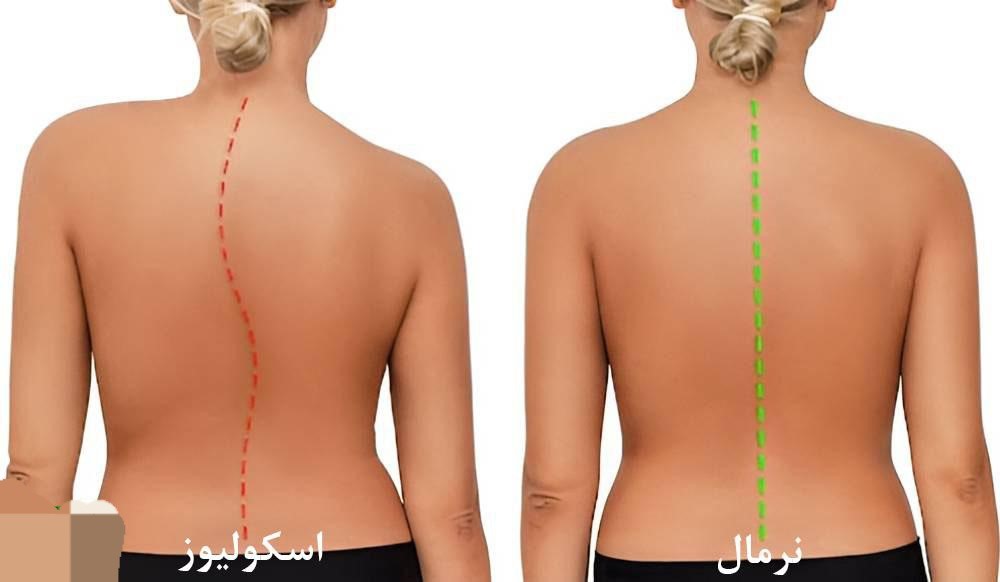 تغییر ظاهر و شکل بدن: