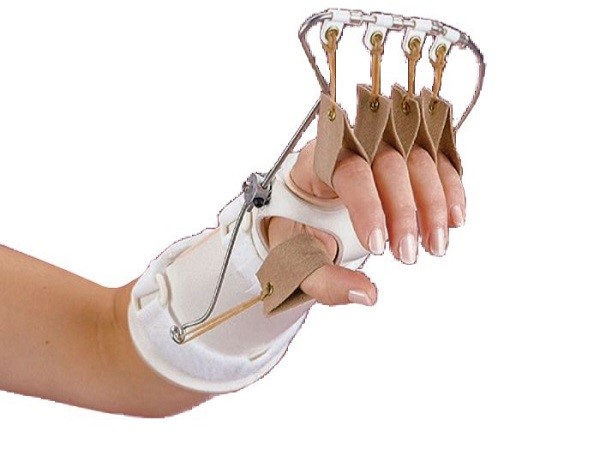 پس از یک دوره استفاده از اسپلینت عنکبوتی چه تغییراتی به وجود می آید؟